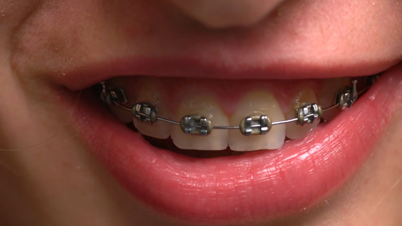 DNS (2016) thumbnail